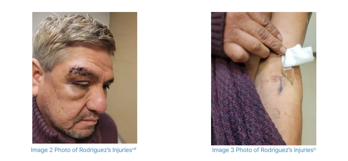 Rodriguez's injuries